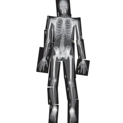 Human X-Rays on Film